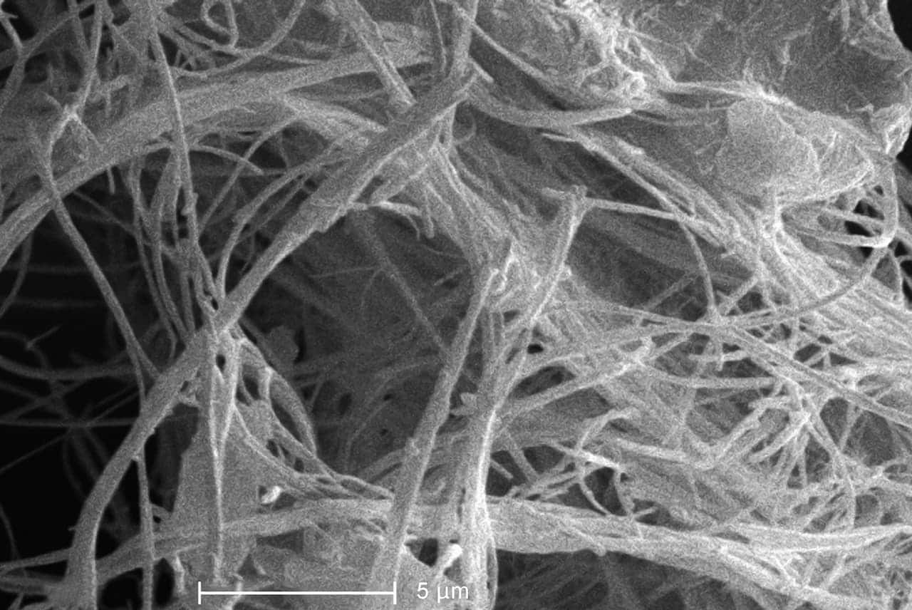 Microscopic view of asbestos fibres